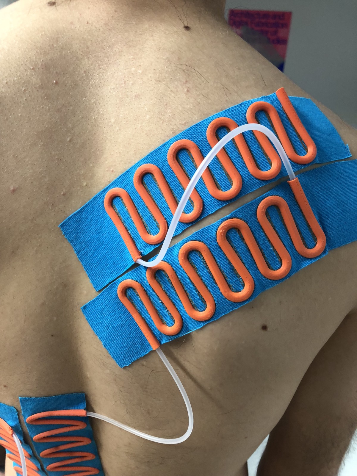 PipeLink attached